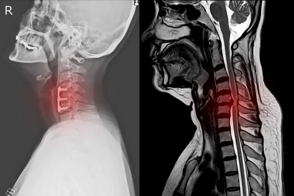 Demonstrative evidence in a personal injury trial