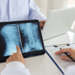 Spine x-rays on tablet - Uber Car Accident Lawyer Houston, Texas