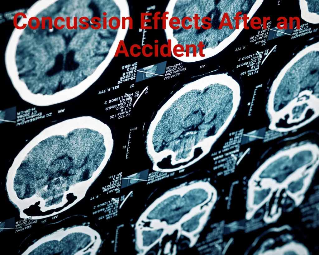 Concussion effects after an accident