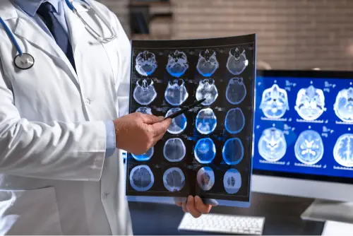 Understanding Blunt Force Head Trauma