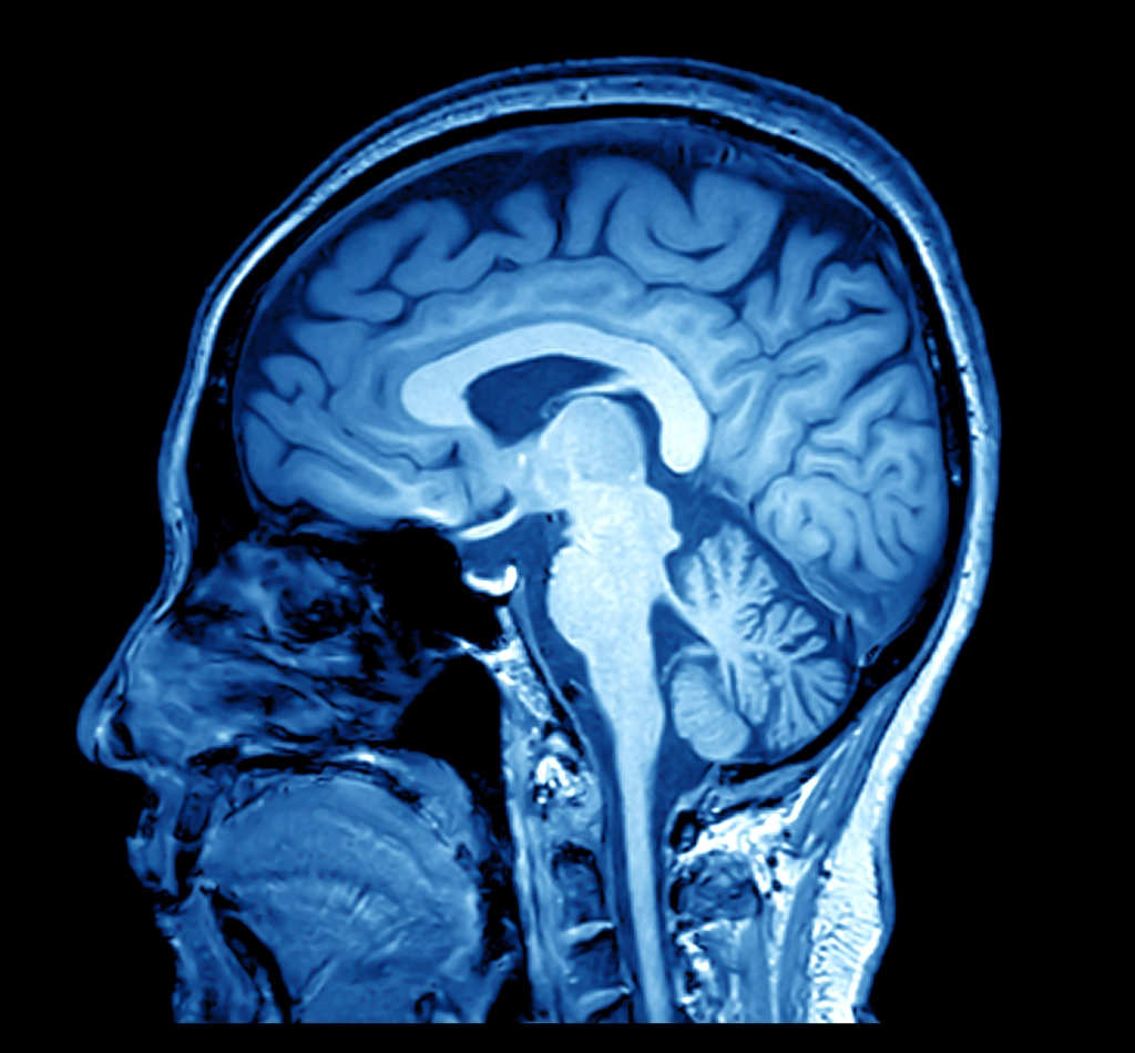 Documenting damages in brain injury claims - injured brain