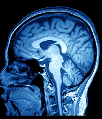 How To Handle A Traumatic Brain Injury Case In Houston