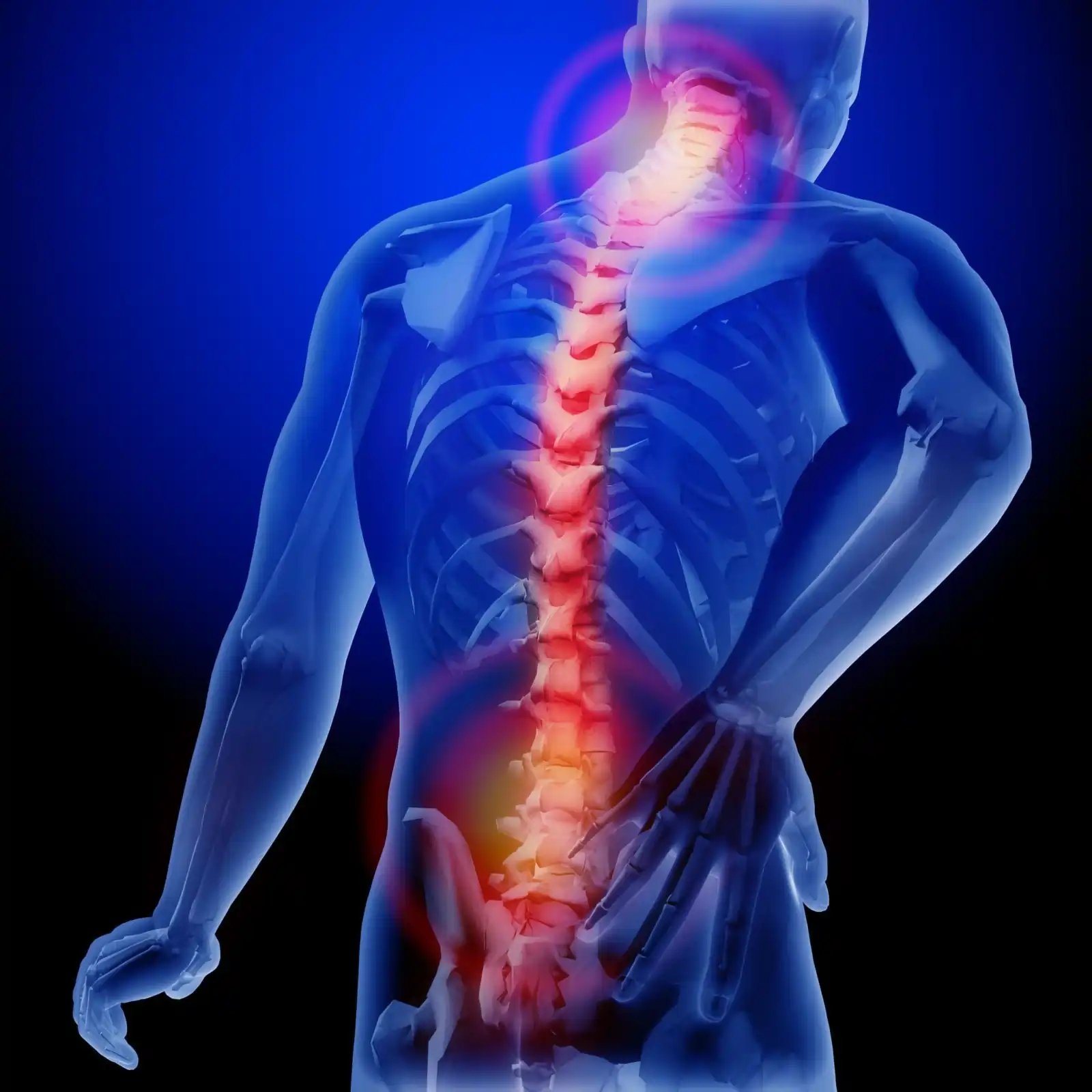 Diagram of spinal cord injury levels: cervical, thoracic, lumbar, and sacral