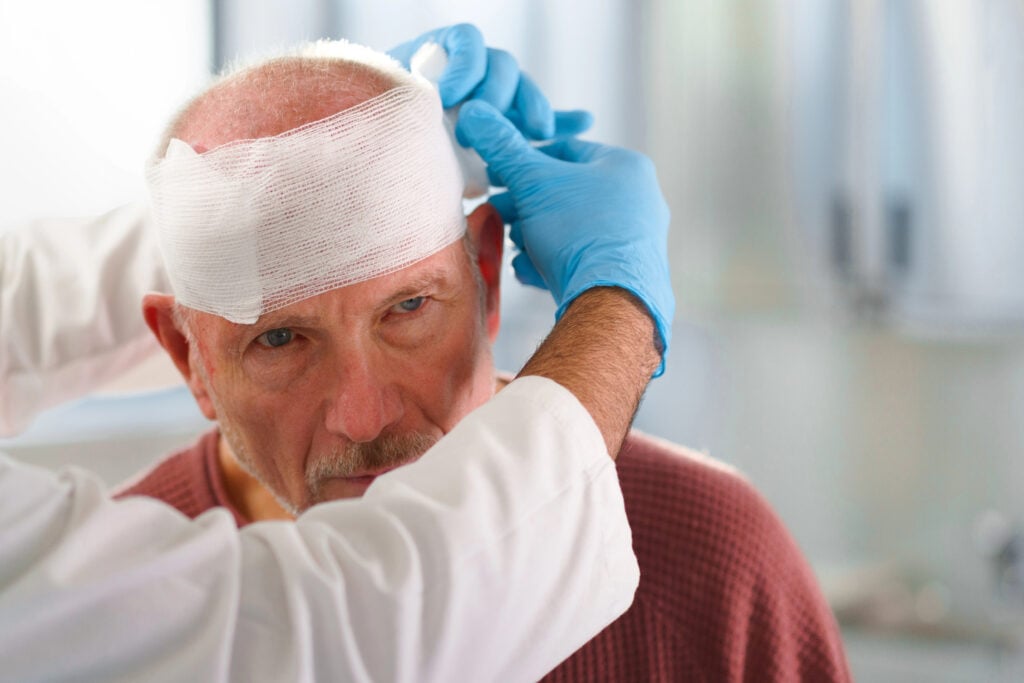 Traumatic Brain Injury in Houston