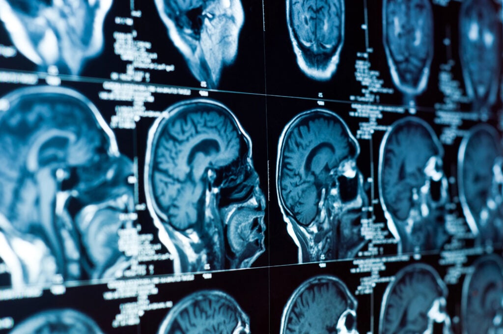 Doctors diagnose brain injuries through neurological examinations, cognitive testing, and imaging studies like CT scans or MRIs.